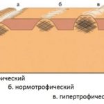 Чому не засмагають шрами на тілі