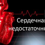 Сердечная недостаточность: мифы против фактов